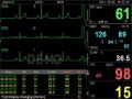 Kardiomonitor PC-3000 2.jpg