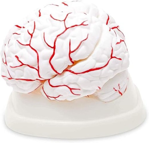 Model mózgu z tętnicami 8 części.jpg