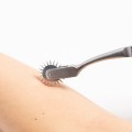 Neurologiczne koło Wartenberga 18 cm – precyzyjne narzędzie diagnostyczne do badania czucia powierzchniowego 3.jpg