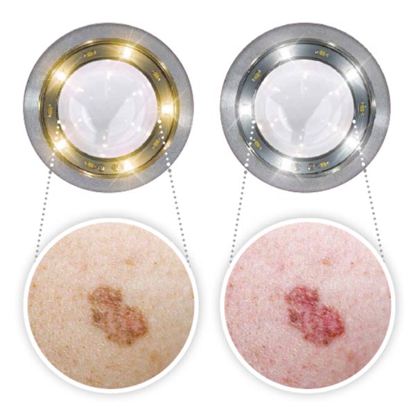 Dermatoskop Luxamed LuxaScope CCT LED – dwie barwy światła, gładka płytka kontaktowa 2.jpg