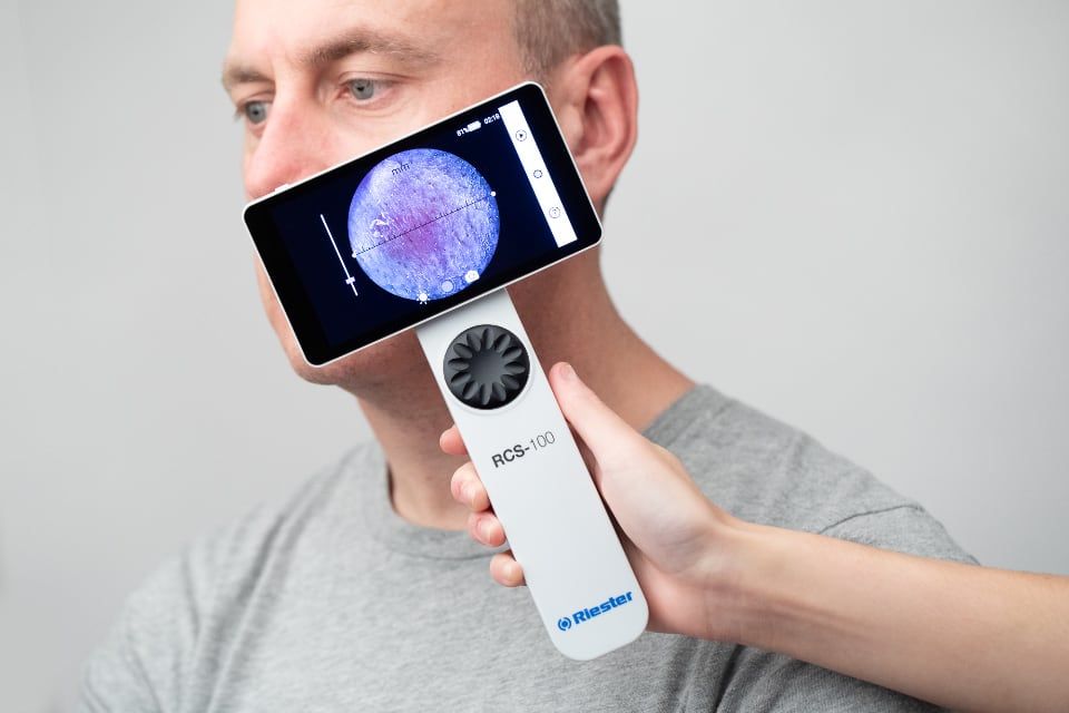 Dermatoskop cyfrowy RCS-100